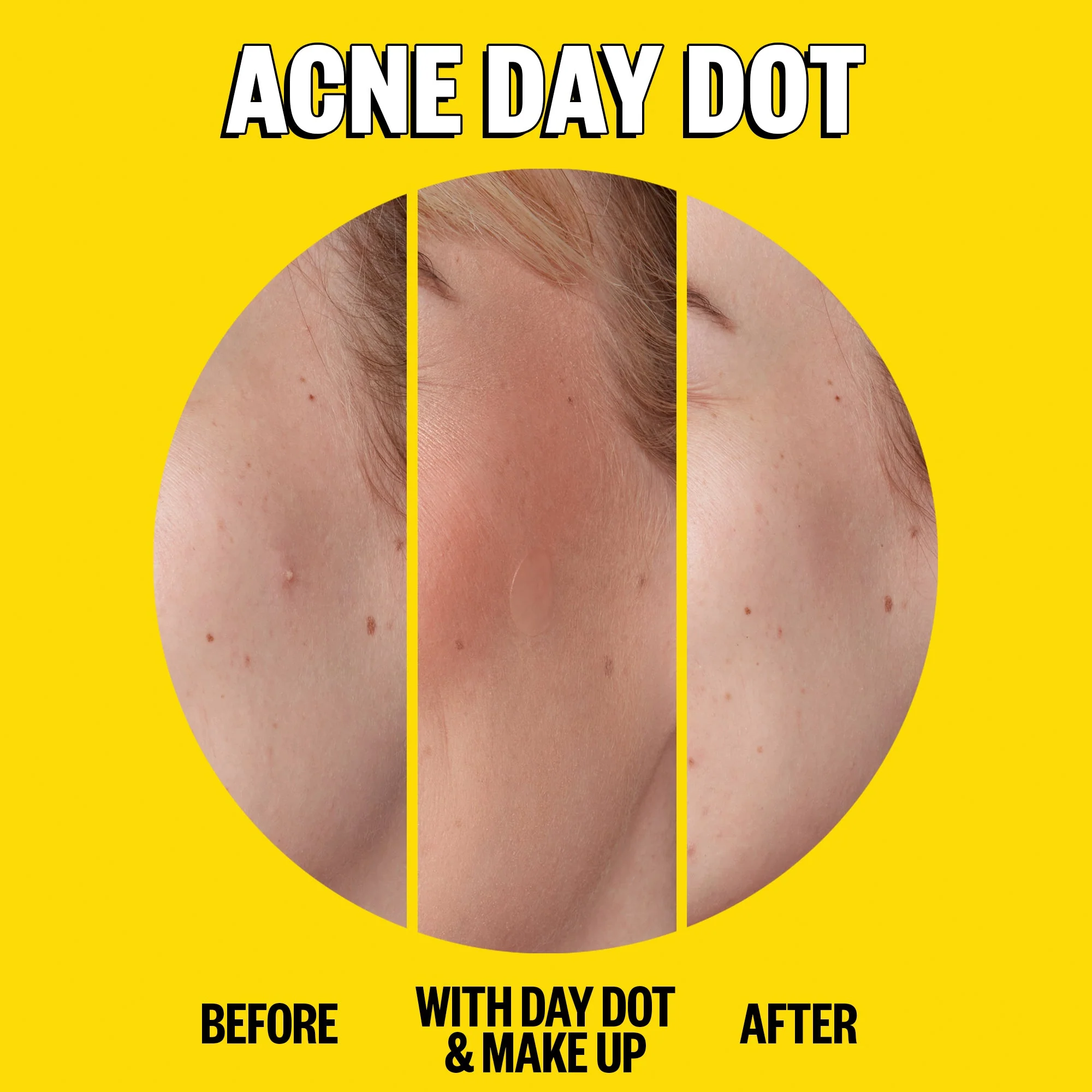 Acne Day & Night Duo (CAN) - Image 3