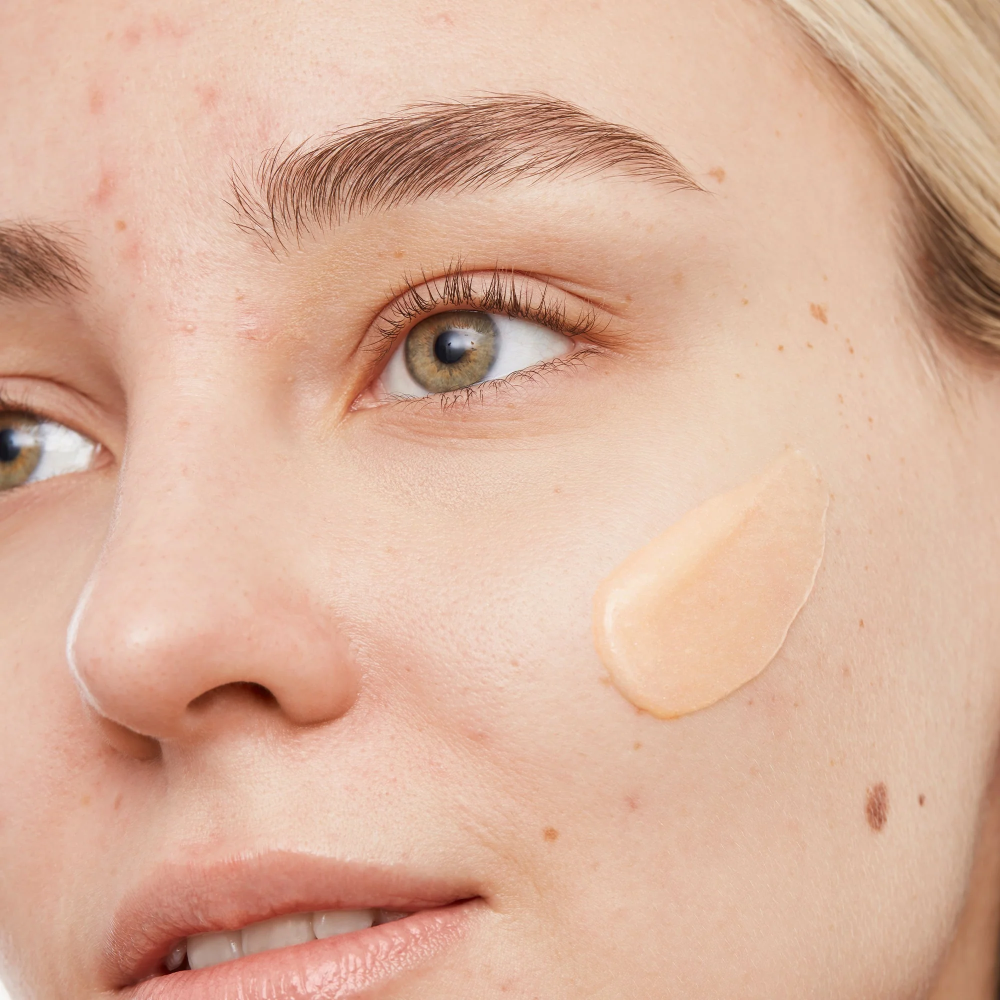 Acne Gel Cleanser (CAN) - Image 5