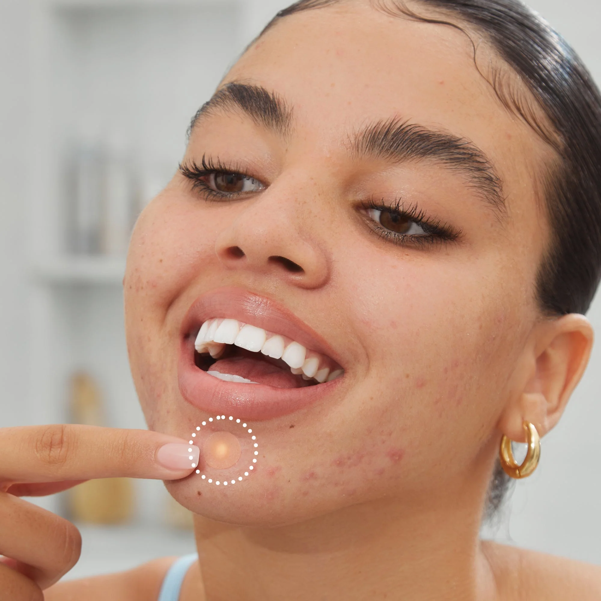 Acne Healing Dots (UNI) - Image 10