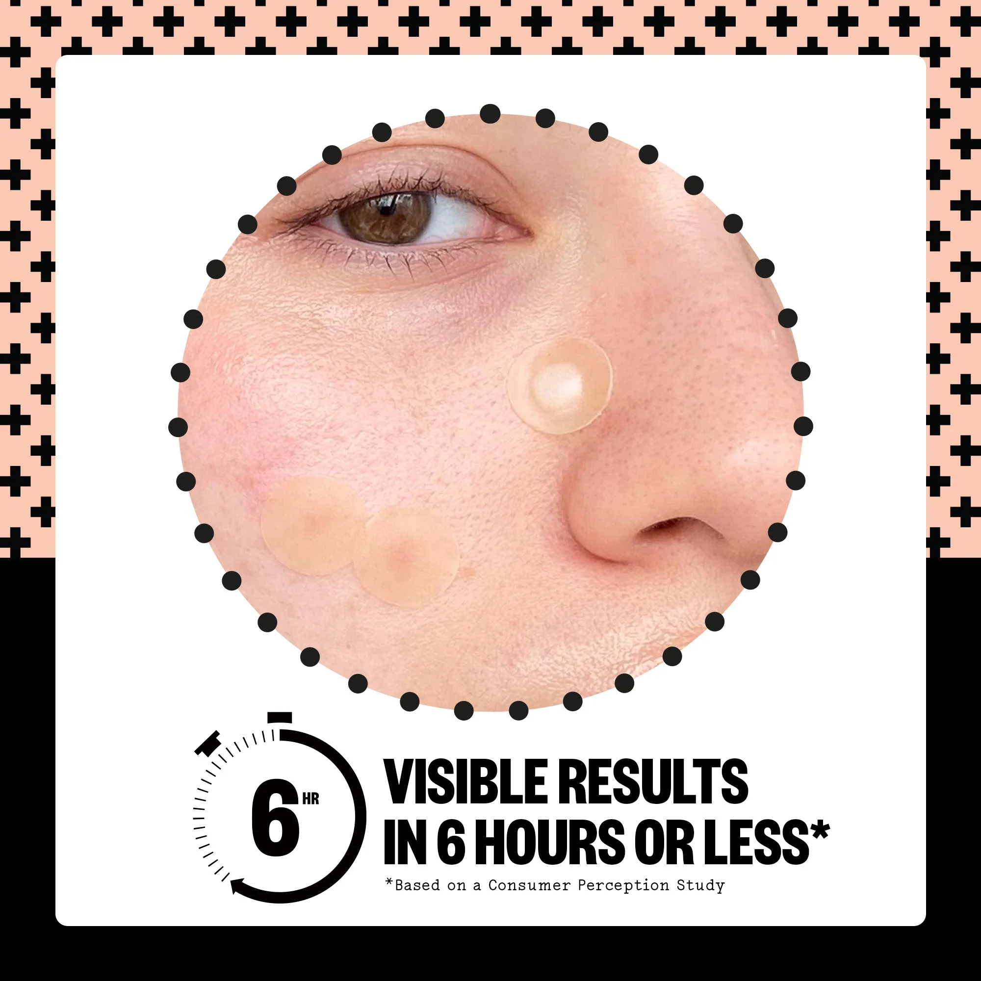 Acne Healing Dots (UNI) - Image 14