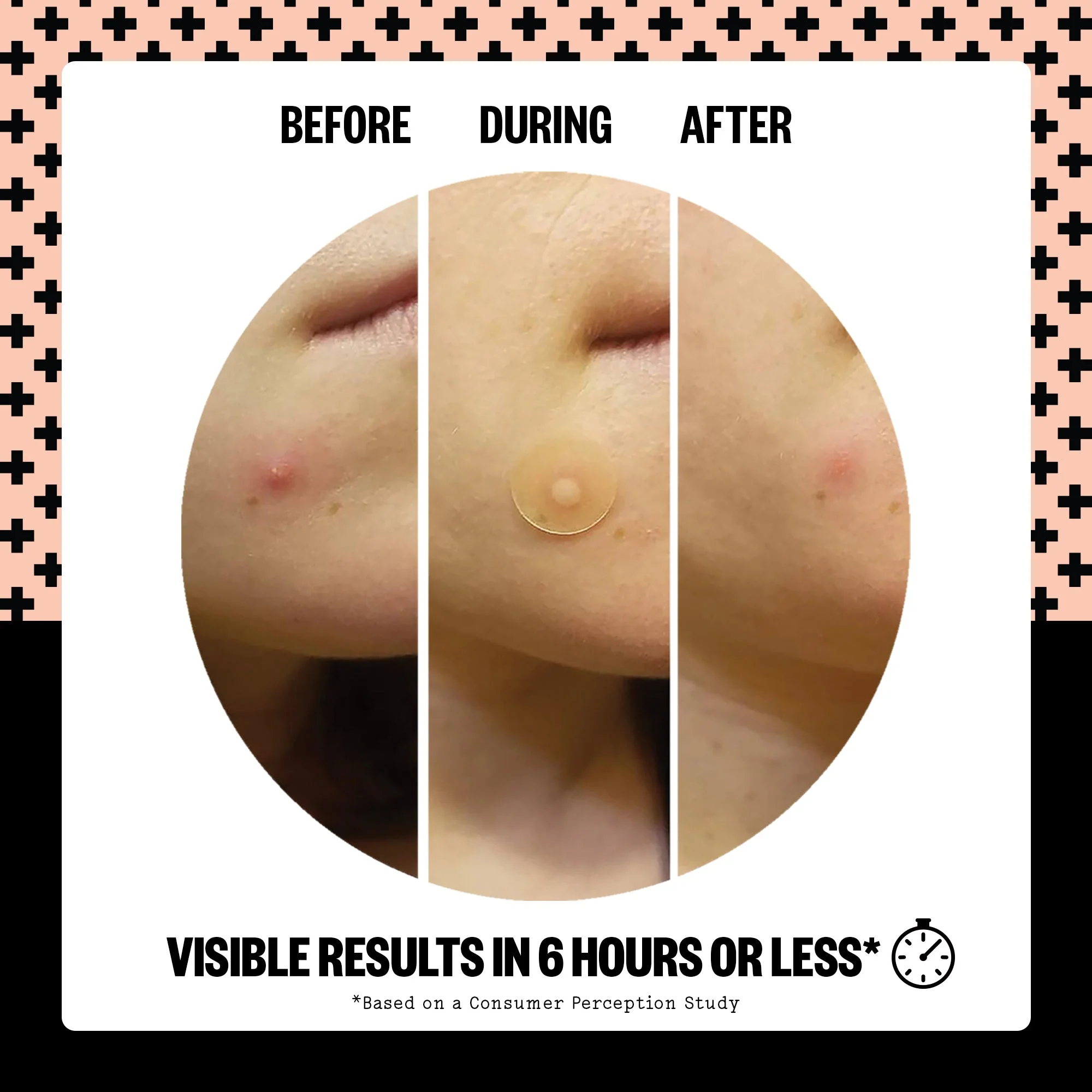 Acne Healing Dots (UNI) - Image 5