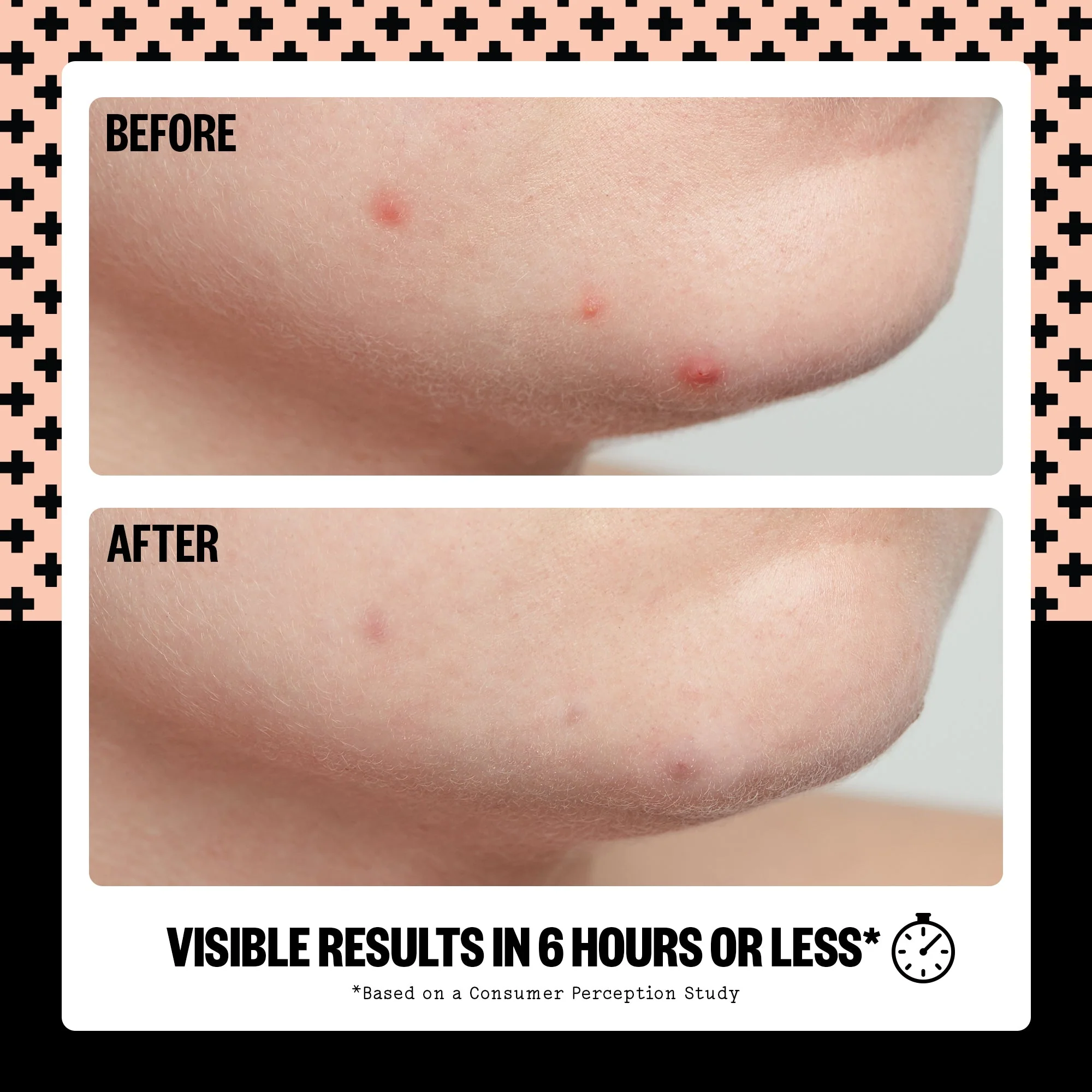 Acne Healing Dots (UNI) - Image 6