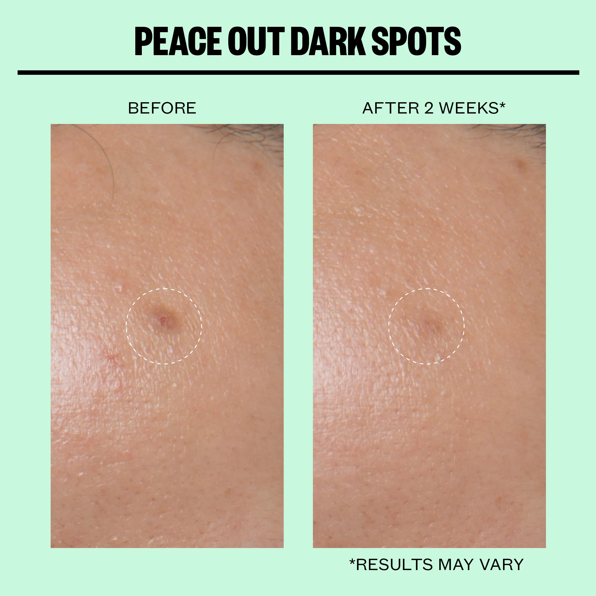 Dark Spots Microneedling Dots (CAN) - Image 4