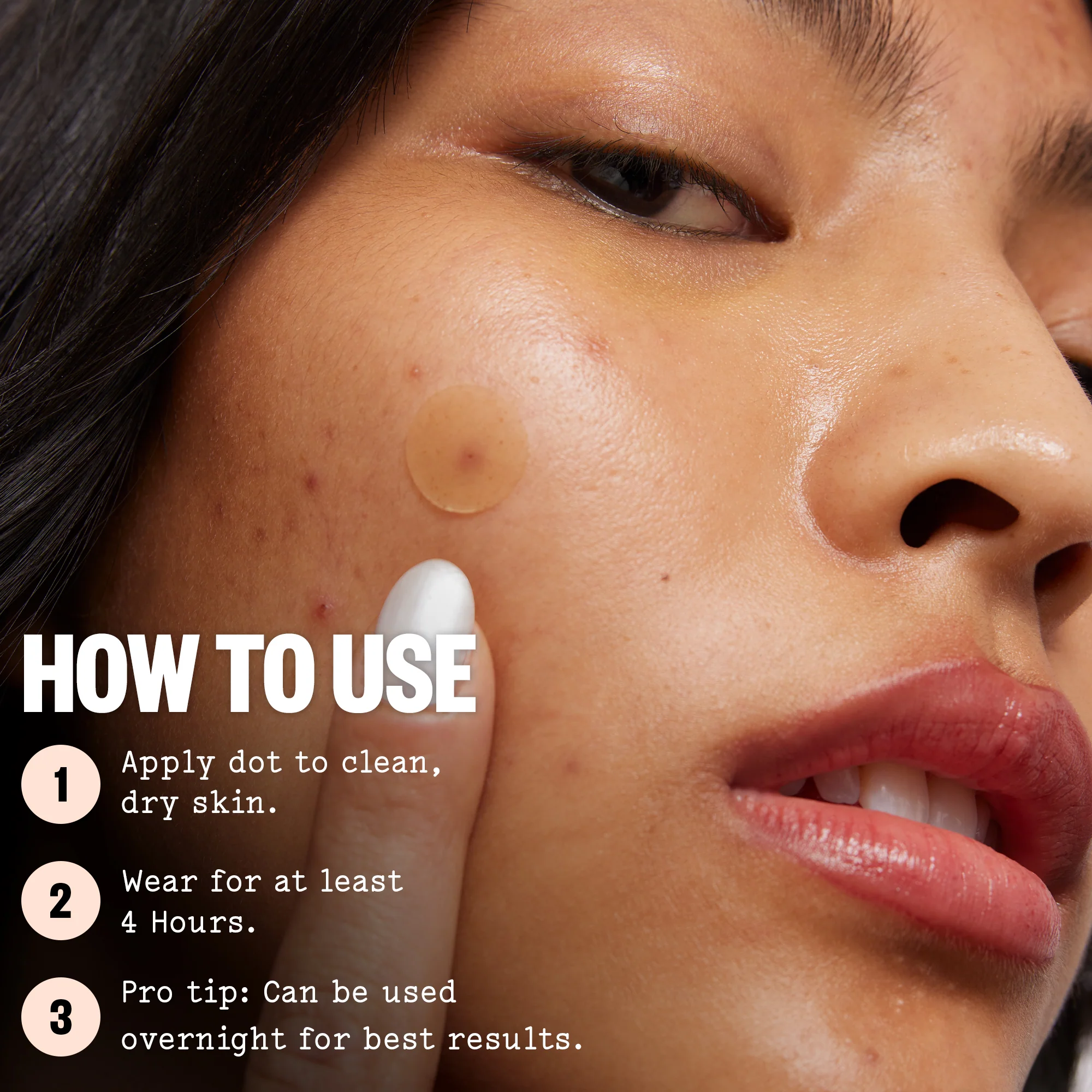 Acne Treatment Dots - Image 5