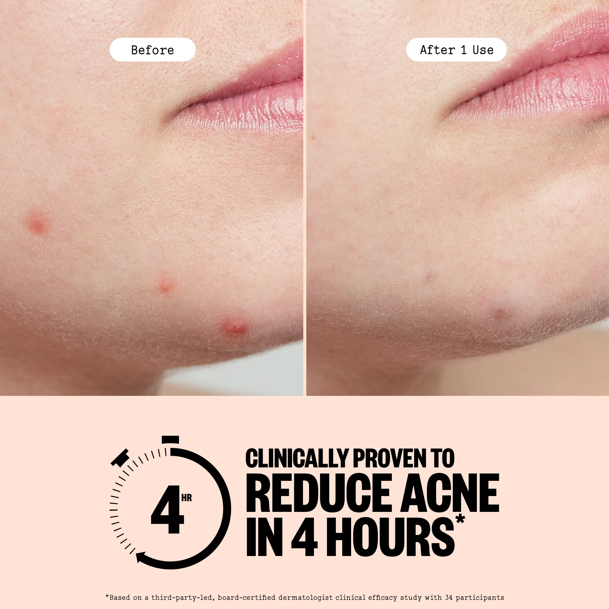 Acne Treatment Dots - Image 7
