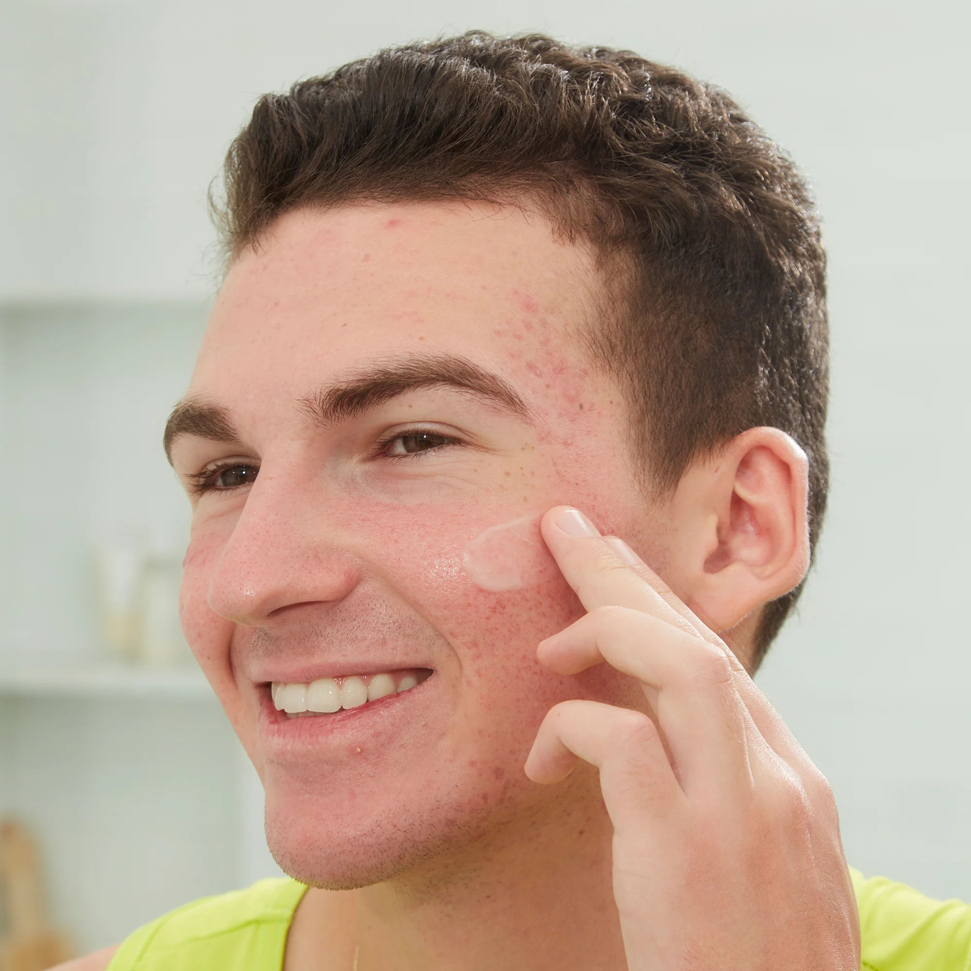 Acne Serum - Image 9