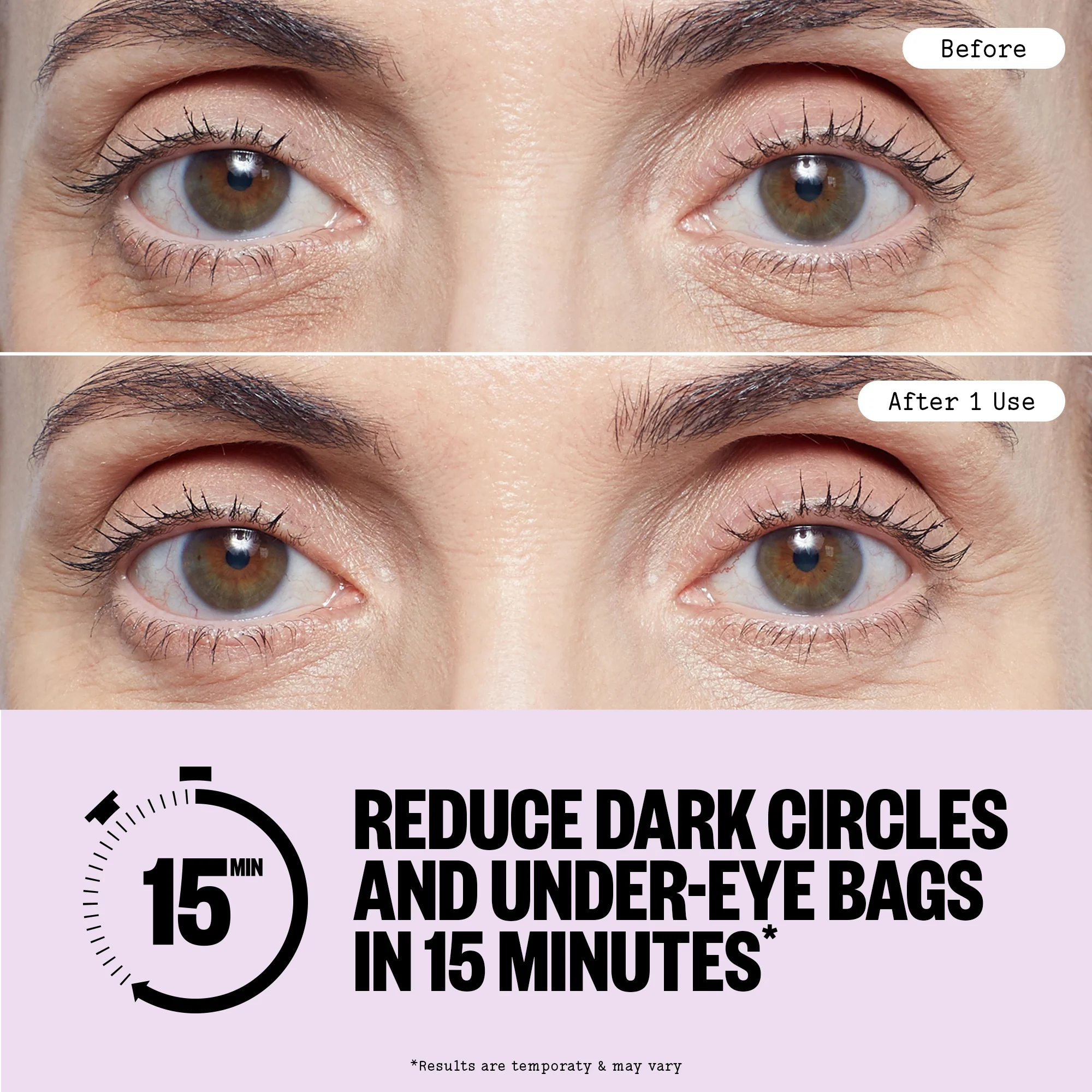Puffy Eyes (CAN) - Image 7