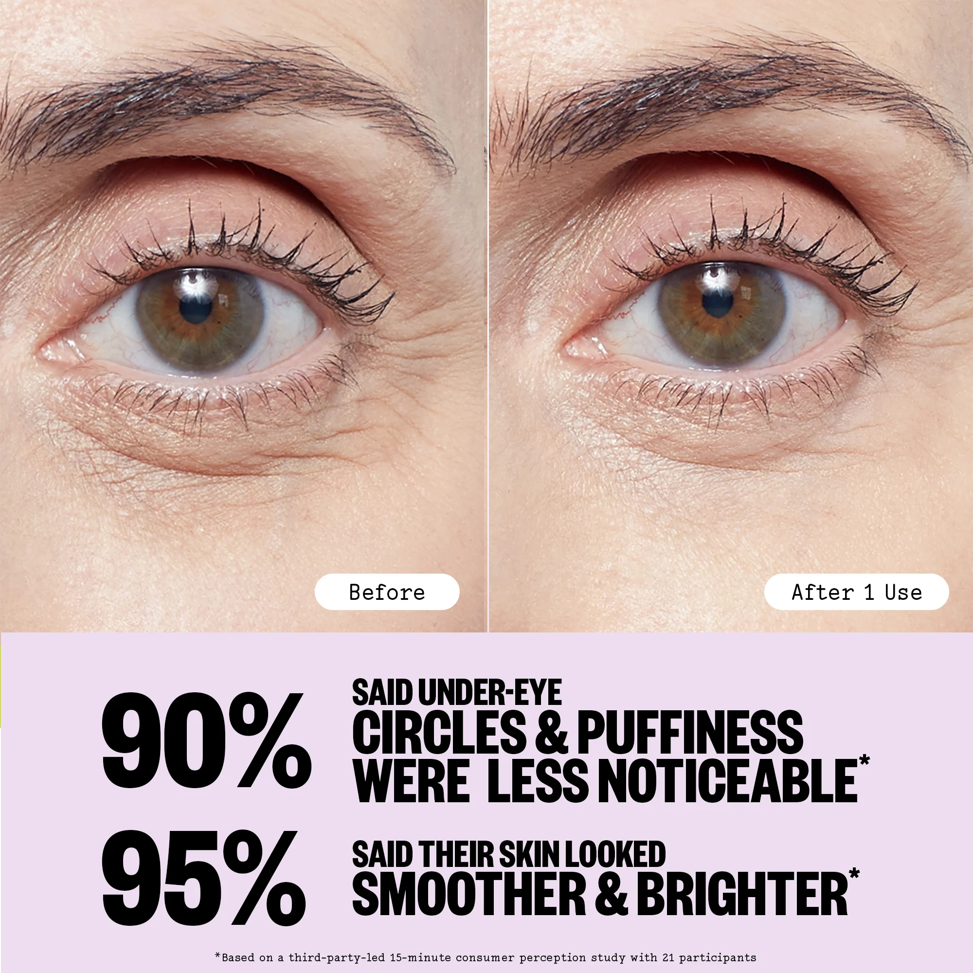 Puffy Eyes (CAN) - Image 6