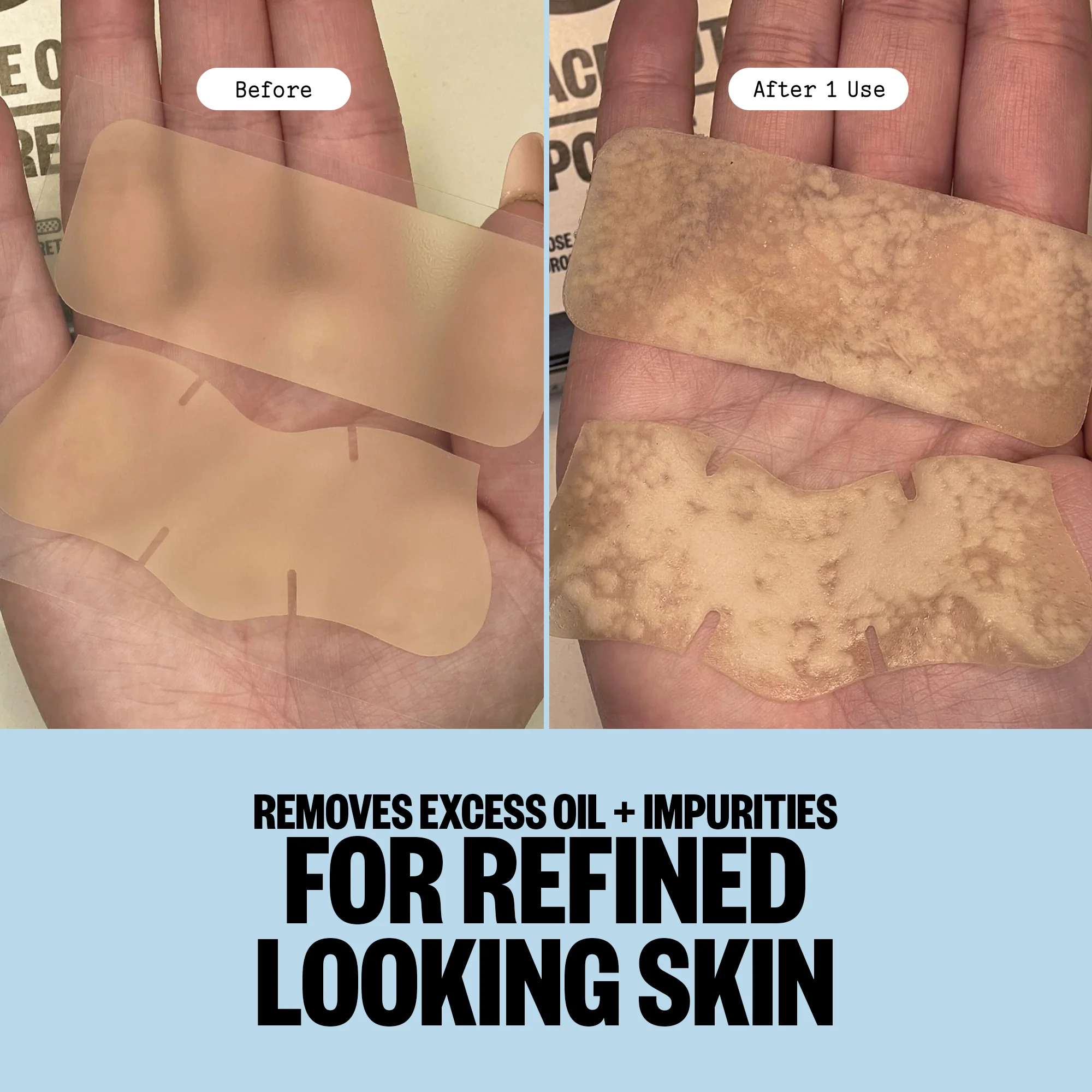 Pore Minimizing Strips (CAN) - Image 6