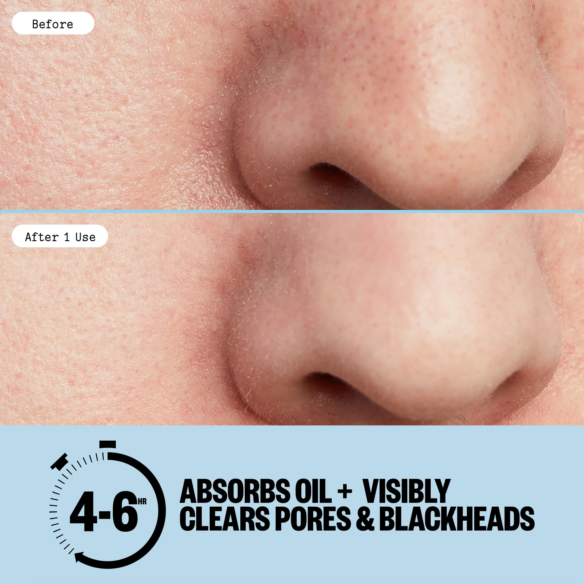 Pore Minimizing Strips (CAN) - Image 7