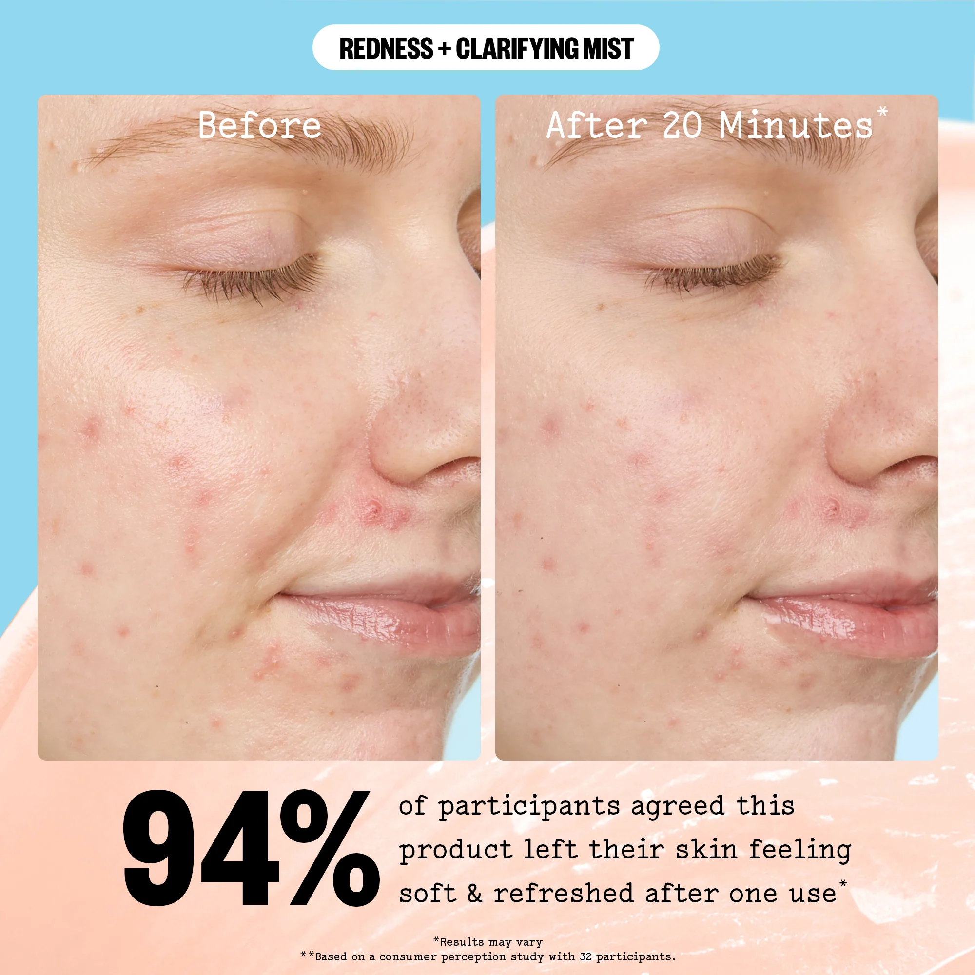 Redness + Hydrating Clarifying Mist - Image 11