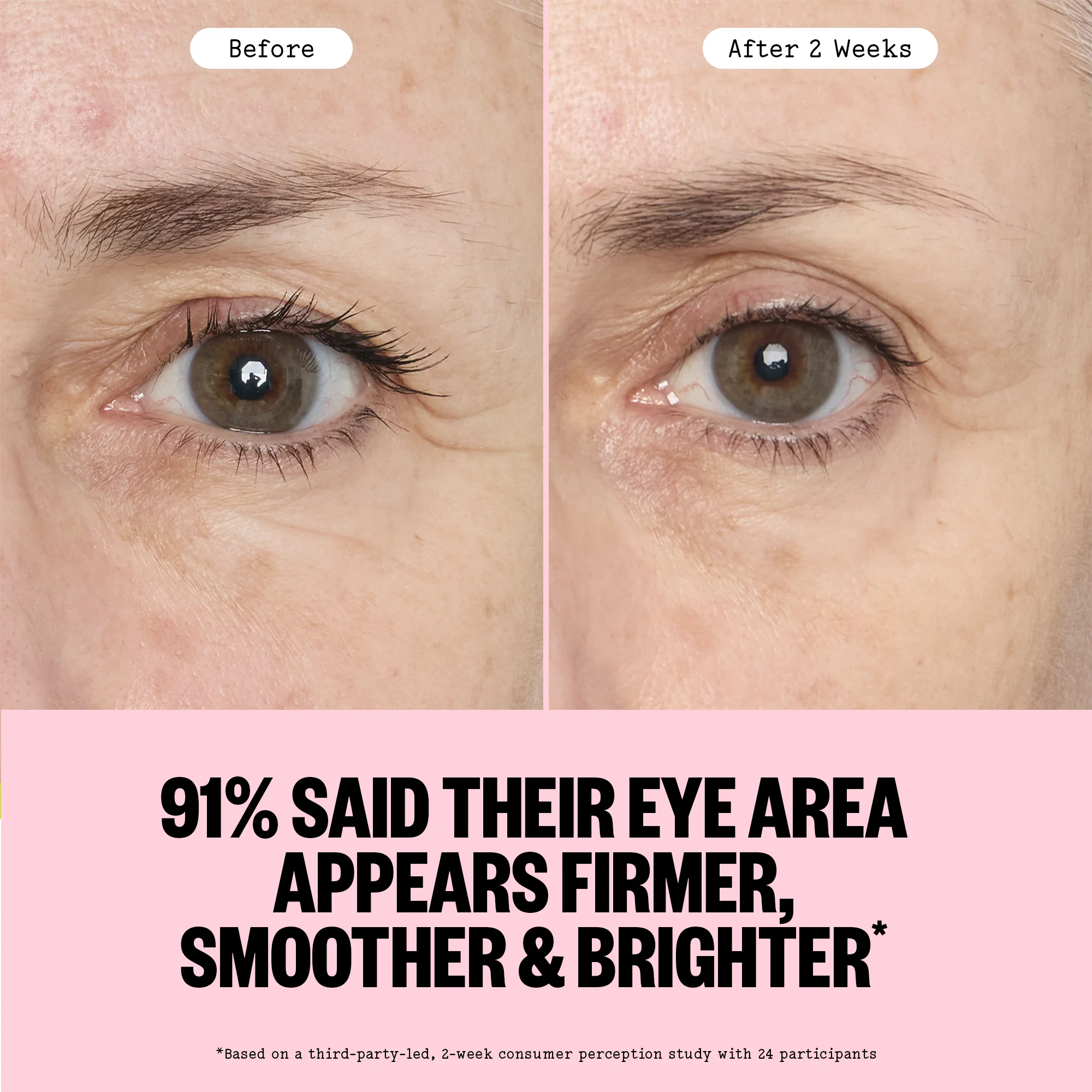 Retinol Eye Lift Patches - Image 6