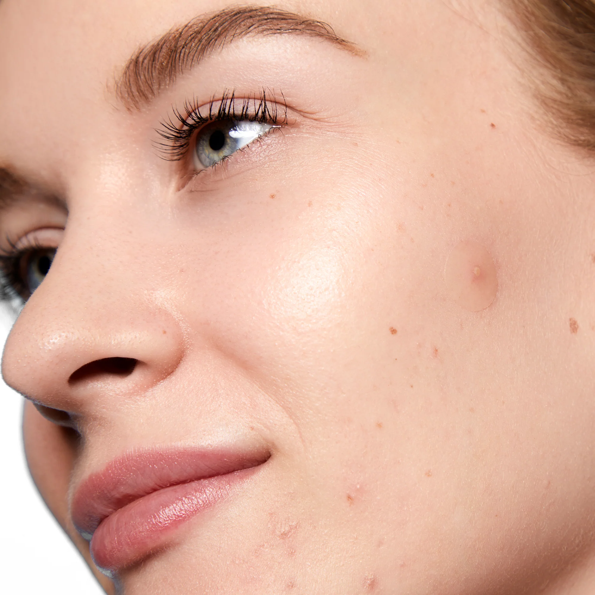 Acne Day Dots - Jumbo - Image 9